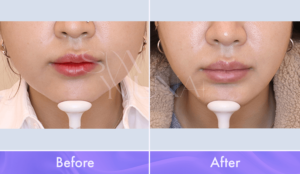 Magic V Cat Archives - Dr. Sonyouna Clinic